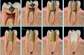 Treadent Diş Kliniği, Protez, İmplant, Ortodonti, Estetik Diş Hekimliği, Pedodonti, Restoratif(Dolgu) Tedavi, Endodontik(Kanal)Tedavi, Periodontoloji(Diş Eti) Tedavi, Hamilelikte Ağız Bakımı, Sedasyonla Diş Tedavisi, Cerrahi İşlemler